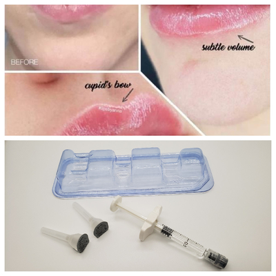 2ml क्रॉस लिंक्ड डर्मल फिलर हाई हा कंसंट्रेशन 24mg/Ml Anti wrinkles