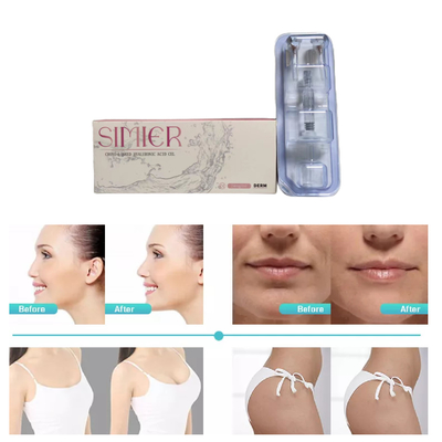 2ml क्रॉस लिंक्ड डर्मल फिलर हाई हा कंसंट्रेशन 24mg/Ml Anti wrinkles