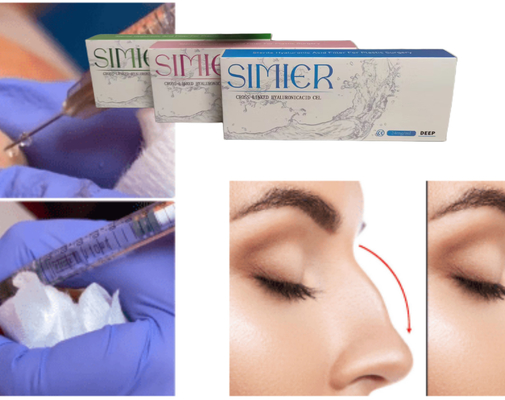 चेहरे के लिए Hyaluronic Acid Dermal Filler Gel इंजेक्शन 20mg/ml क्रॉस लिंक्ड
