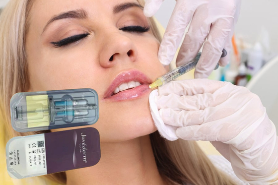 भराव Hyaluronic Acid Gel 5ml Lip Dermal Filler इंजेक्शन इंजेक्शन योग्य त्वचा भराव