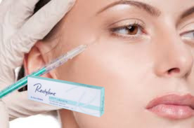 गहरी रेखाएं चेहरे की त्वचा भरने वाली Marionette Line Filler दर्द को कम करती है