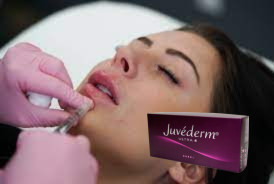 24mg/Ml Juvederm Hyaluronic Acid Dermal Filler फेस इंजेक्शन