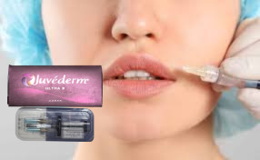 Juvederm Ultra3 Hyaluronic Acid Dermal Filler क्रॉस लिंक्ड HA Filler CE जीएमपी