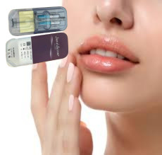 2 X 1 ml Juvederm Ultra 4 इंजेक्शन योग्य त्वचा भरने वाला होंठ भरने वाला इंजेक्शन