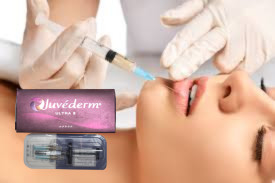 2x1ml HA Dermal Filler Cheekbone Chin Contouring इंजेक्शन के लिए