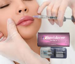 2 X 1 ml Juvederm Ultra 4 इंजेक्शन योग्य त्वचा भरने वाला होंठ भरने वाला इंजेक्शन