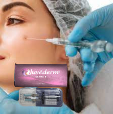 Ultra3 इंजेक्शन योग्य Hyaluronic Acid Gel Juvederm होंठ भरने के लिए त्वचा भराव